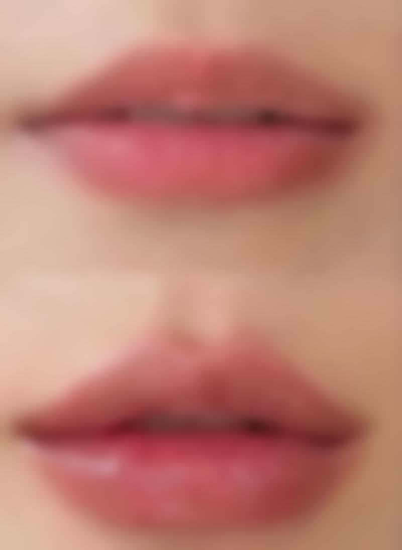 日本Kuno美容整形医院怎么样求美者反馈