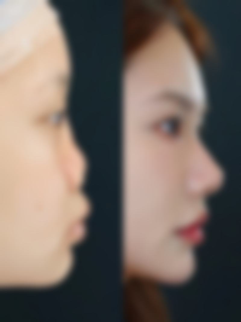 唐山美尚医疗美容门诊部怎么样求美者反馈