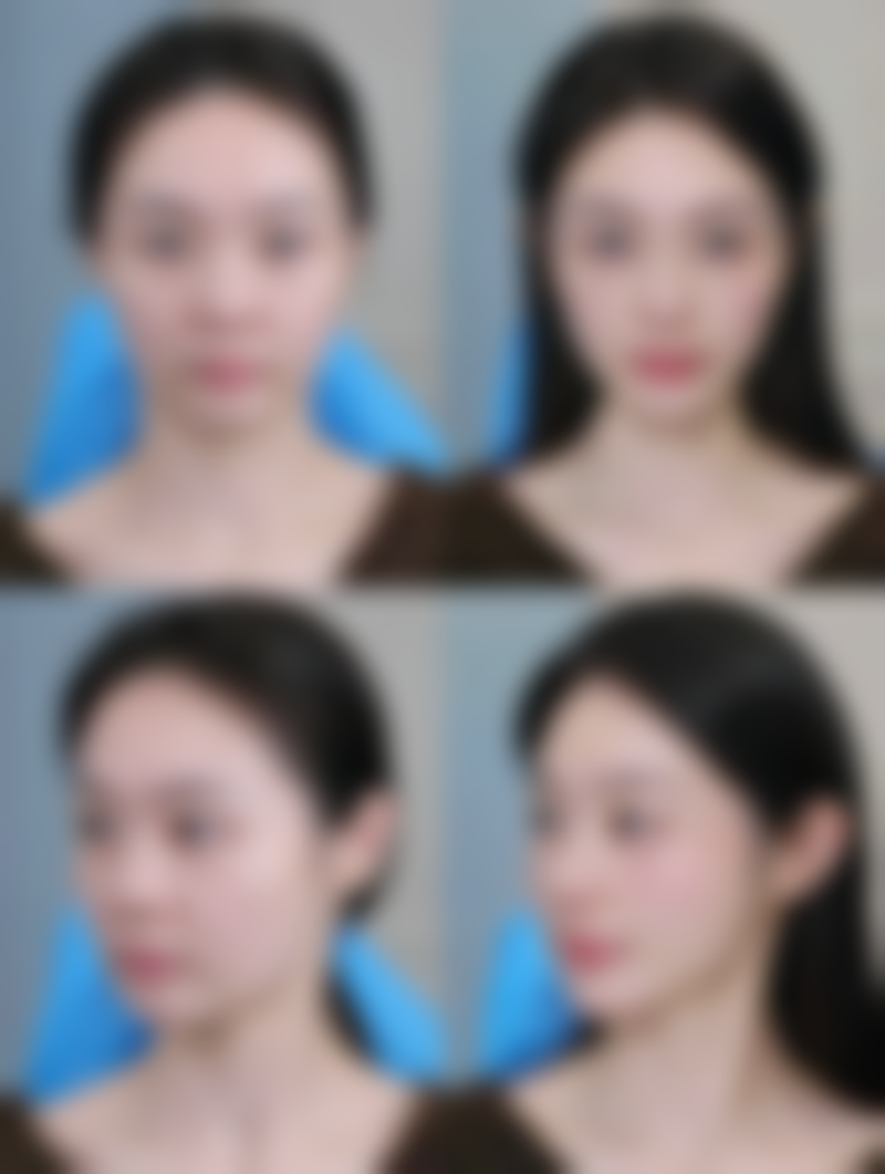 深圳清潭环球美天整形医院怎么样简介概述