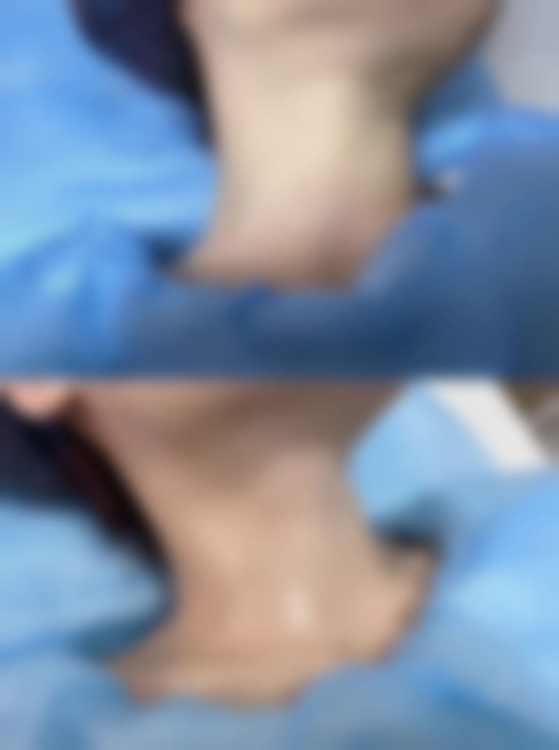 内蒙古兰玫医疗美容门诊部怎么样求美者反馈