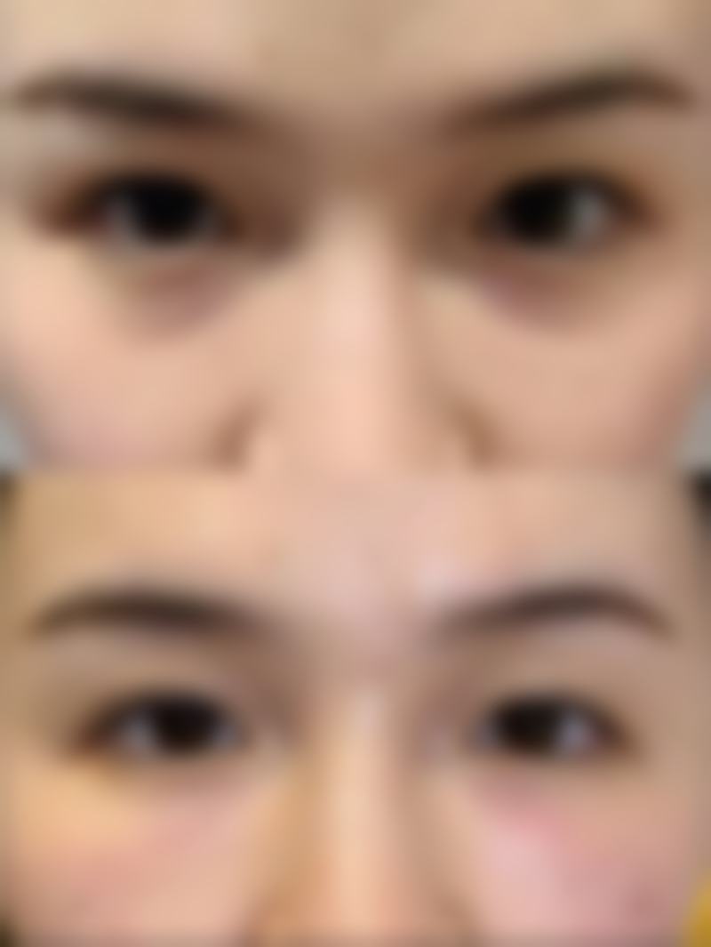 厦门天济医院怎么样求美者反馈