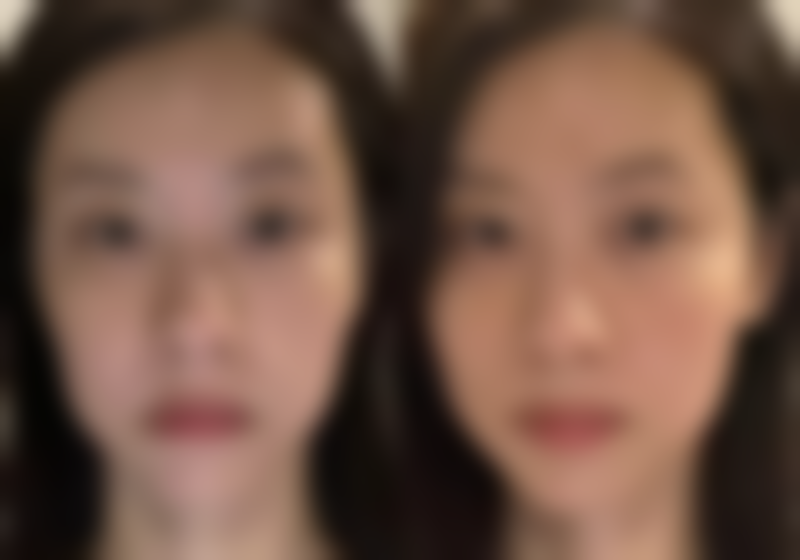 兰州东晶医疗美容门诊部怎么样求美者反馈