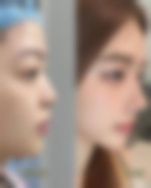 南京连天美医院整形外科怎么样价格收费