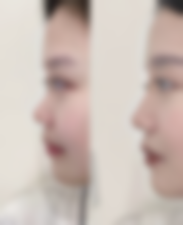 韩国ForU整形外科医院怎么样来院路线