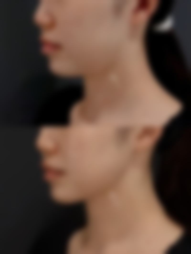 枣庄市中铭美医疗美容诊所怎么样求美者反馈