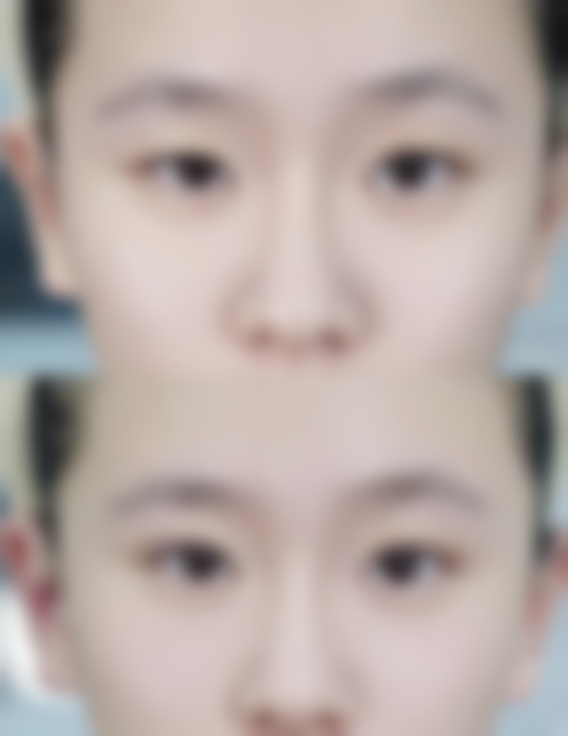 泰国IDL整形外科医院怎么样求美者反馈