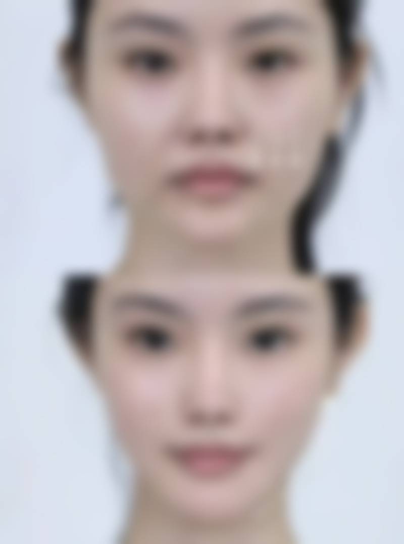 长沙县美颜树整形医院怎么样求美者反馈