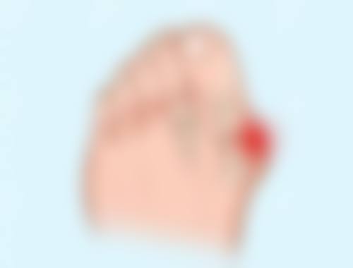 西安爱丁整形怎么样价格收费