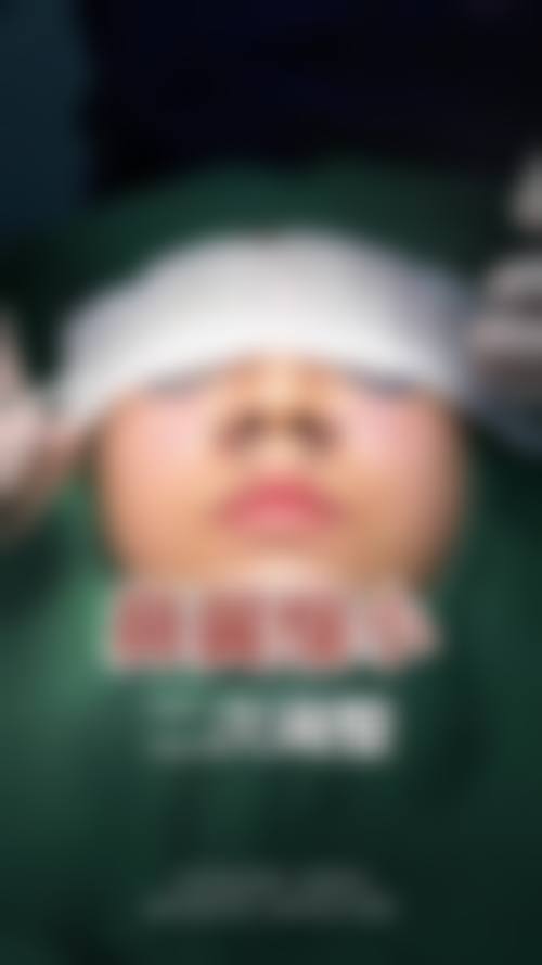 徐航医生助您美丽蜕变