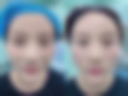 杭州医会整形医院怎么样求美者反馈