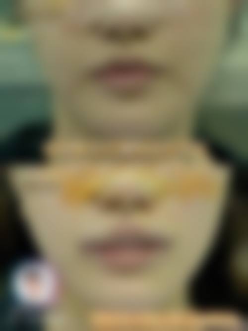 长春长青丽人整形医院怎么样求美者反馈