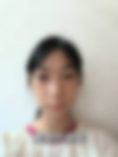 江阴漾禾整形医院怎么样求美者反馈