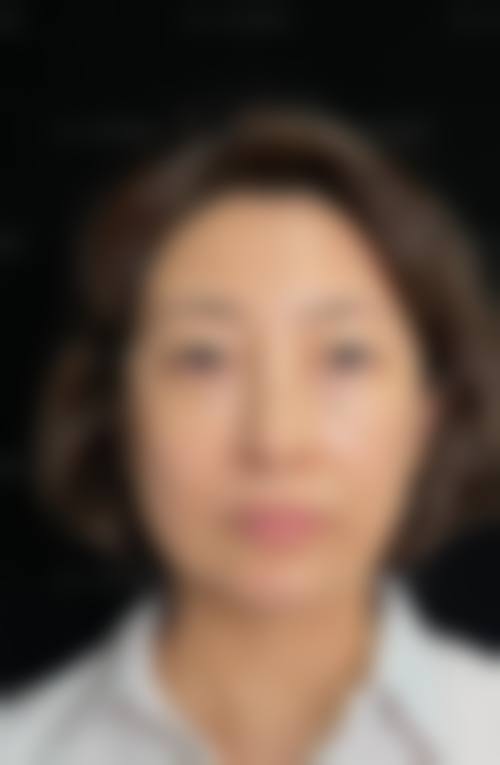 温州林和敏医疗美容诊所怎么样求美者反馈