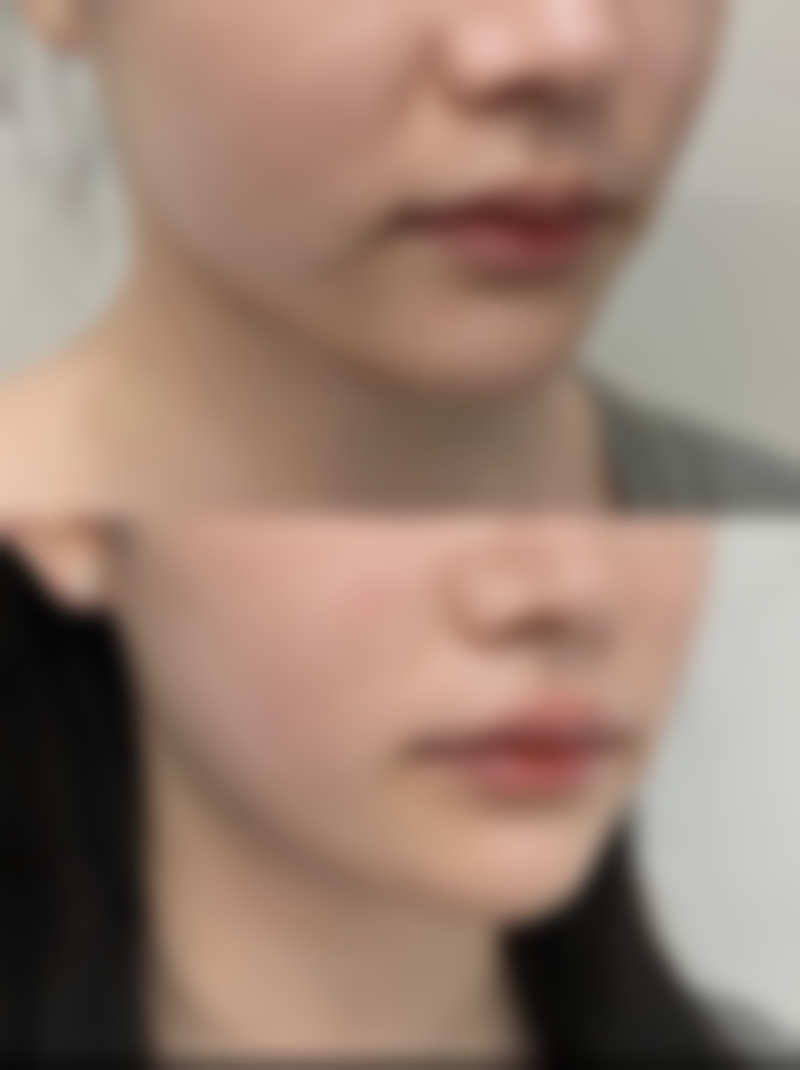 龙岩鸿熙妍医疗美容诊所怎么样医生团队实力