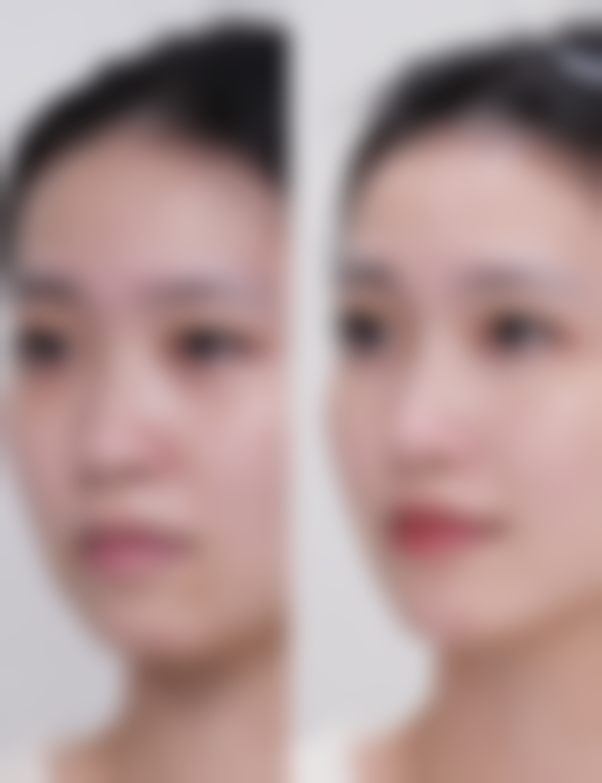 福州吴熙中医院整形美容科怎么样特色项目及技术优势