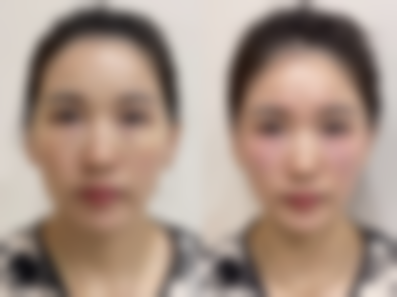 德克莱斯整形外科怎么样来院路线