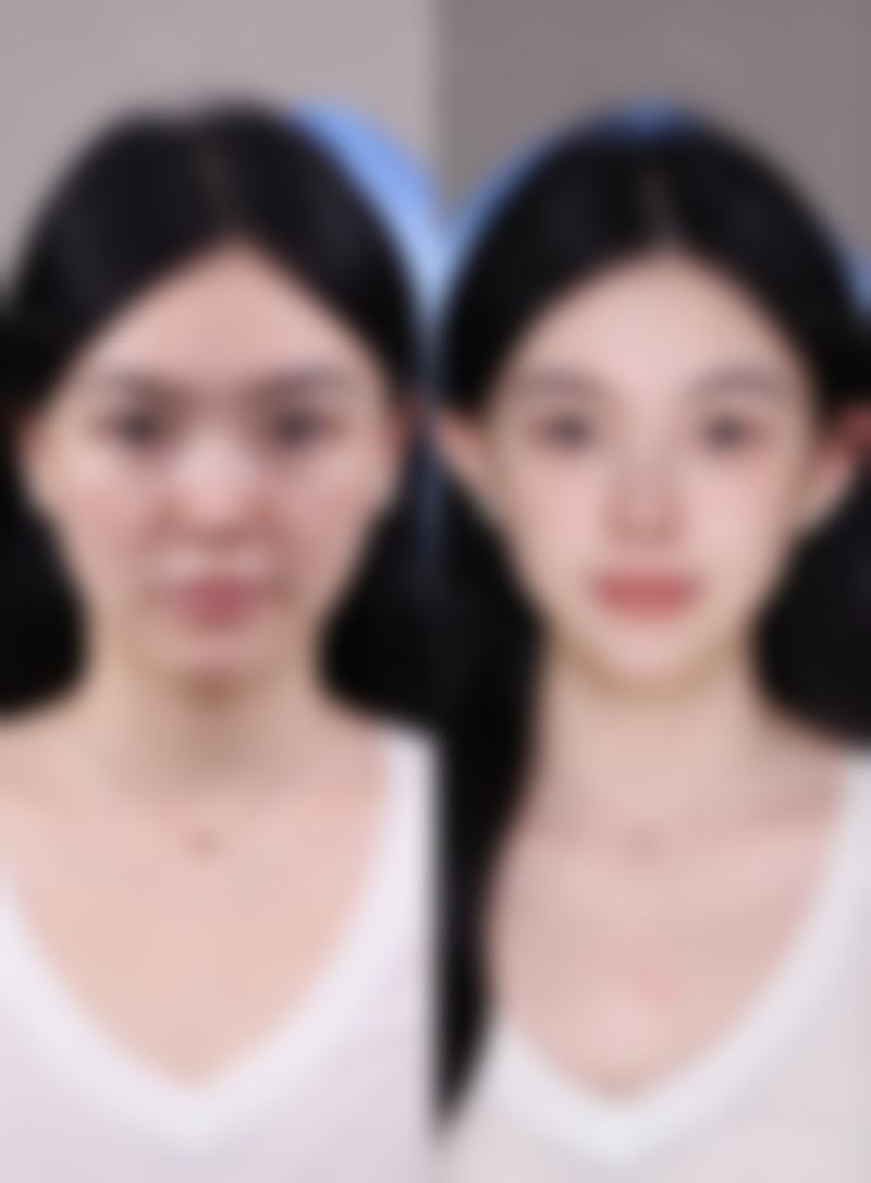 西安爱丁整形怎么样来院路线