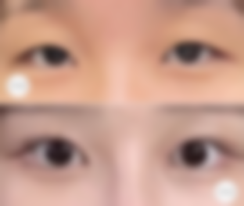 杭州医会整形医院怎么样来院路线