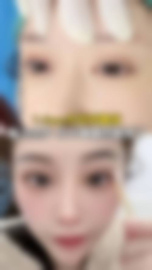 西安靳长安整形医院怎么样价格收费