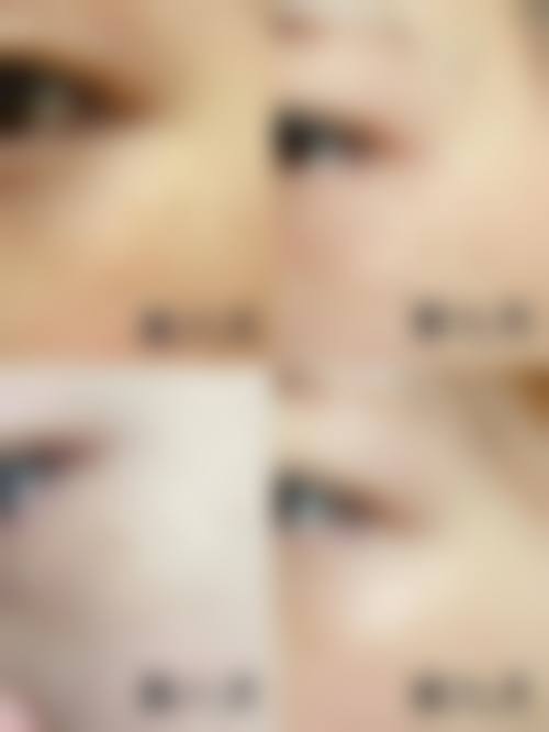 鹤壁戴安娜整形医院怎么样求美者反馈