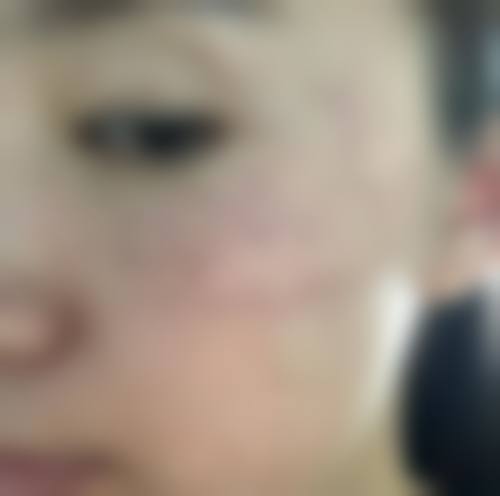 南京章光再度医疗美容门诊部怎么样特色项目及技术优势