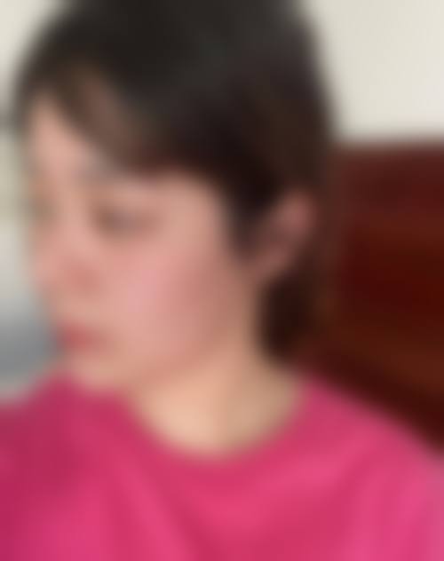 西安靳长安整形医院怎么样医生团队实力