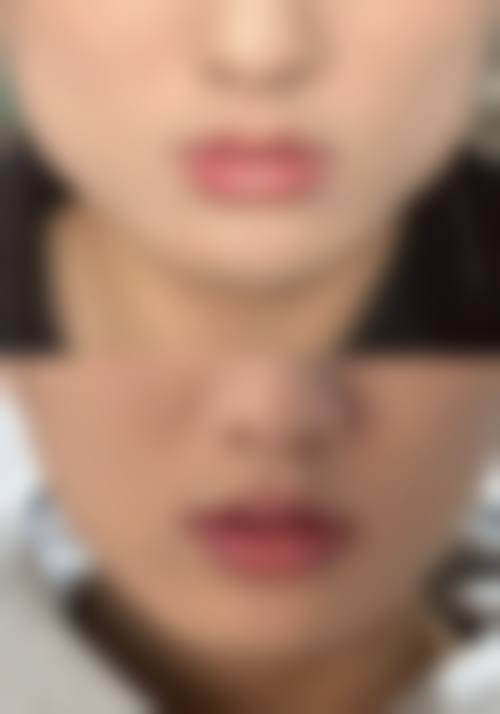 广水摩登美学整形医院怎么样医生团队实力