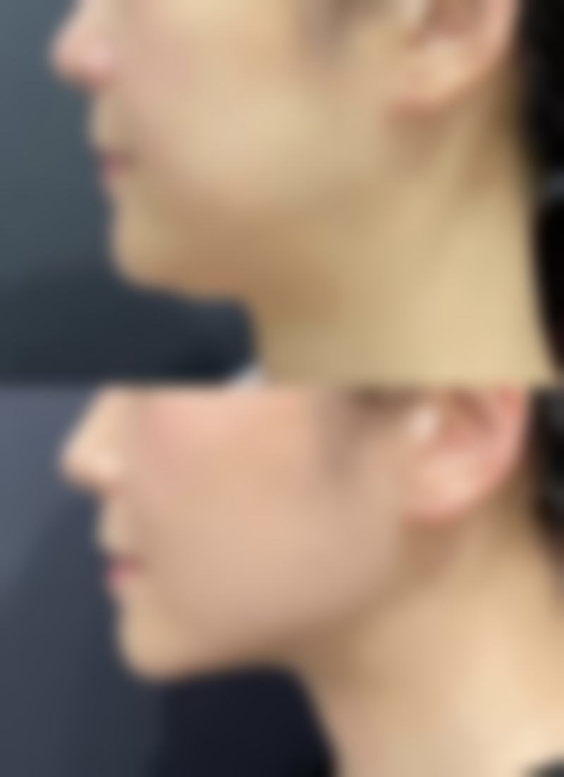 山东佰瑞德泰安医疗美容诊所怎么样价格收费