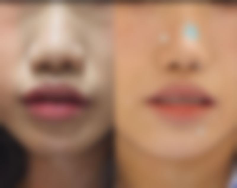 广水摩登美学整形医院怎么样价格收费