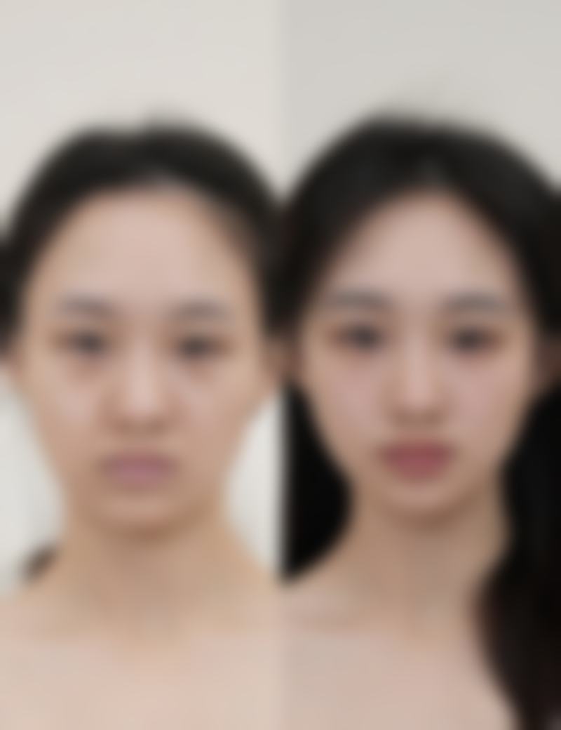 呼和浩特大韩医疗美容门诊部怎么样价格收费