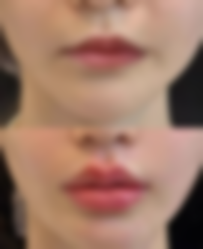 代峰医生的价格与服务保护