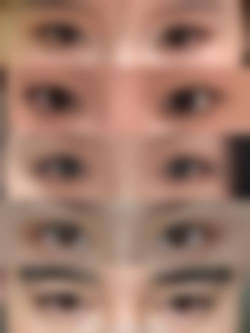 张至德医生的技术特色