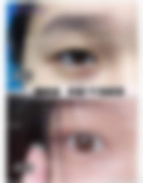 选择洪恺志医生的优势