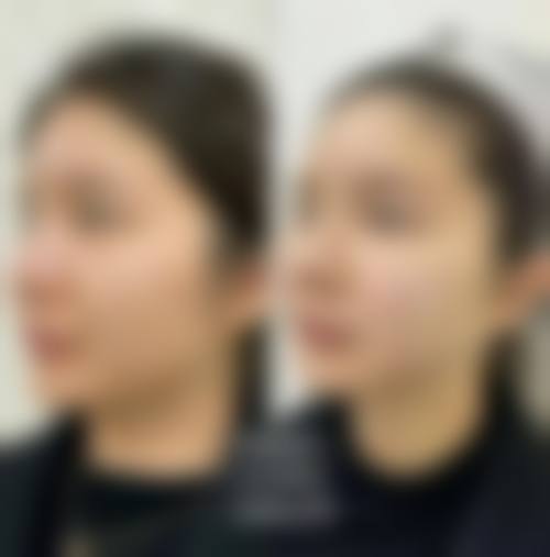 曾明礼医生的综合实力