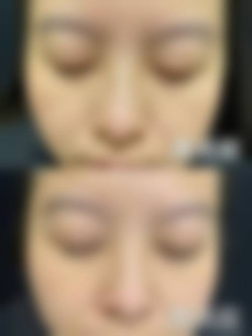 雅安河北医院整形美容科怎么样价格收费