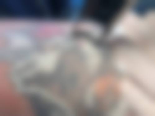 代峰医生丰富的临床经验