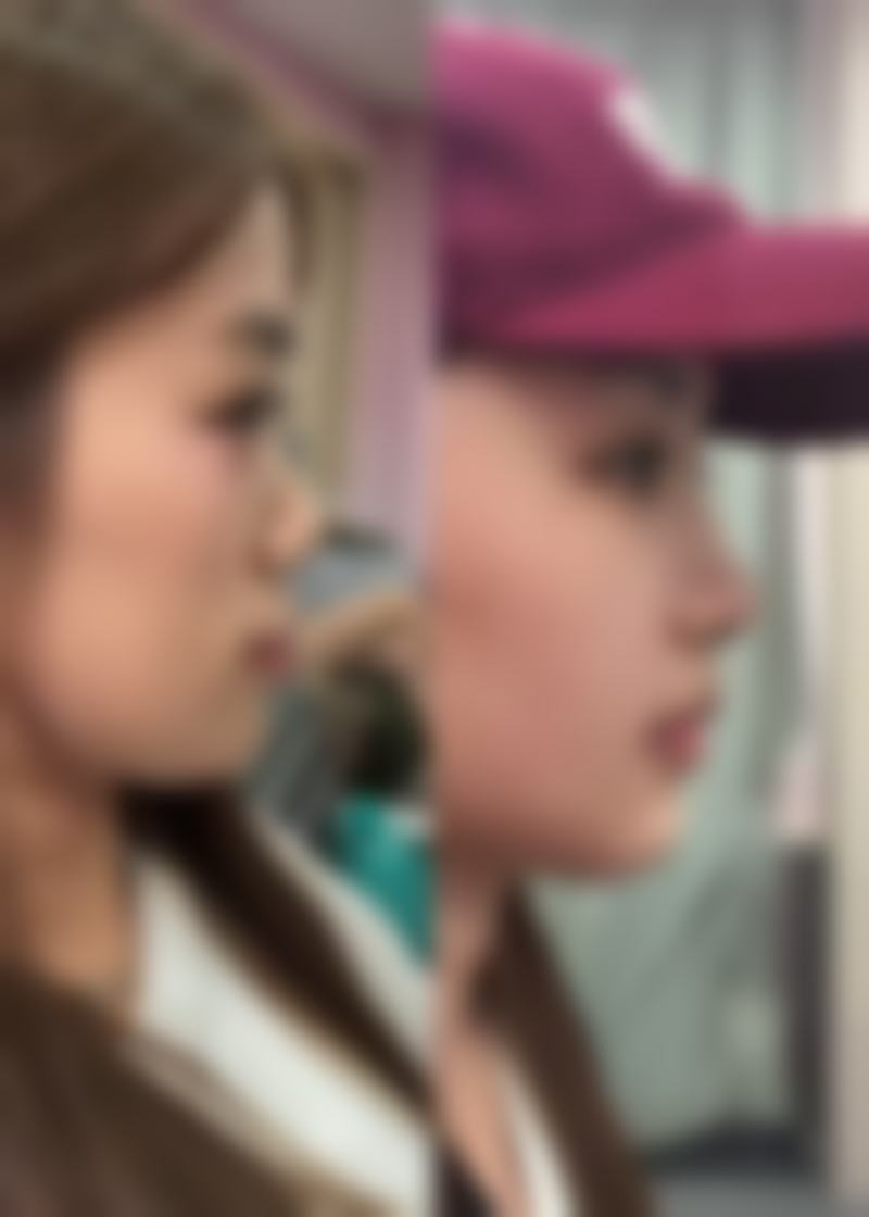 徐航医生助力美丽蜕变实例