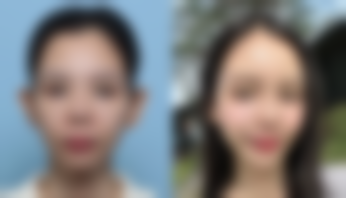 重庆美圣美邦医疗美容门诊部怎么样求美者反馈