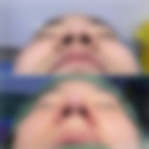 深圳维瑞（广尔美丽）医疗美容门诊部怎么样特色项目及技术优势