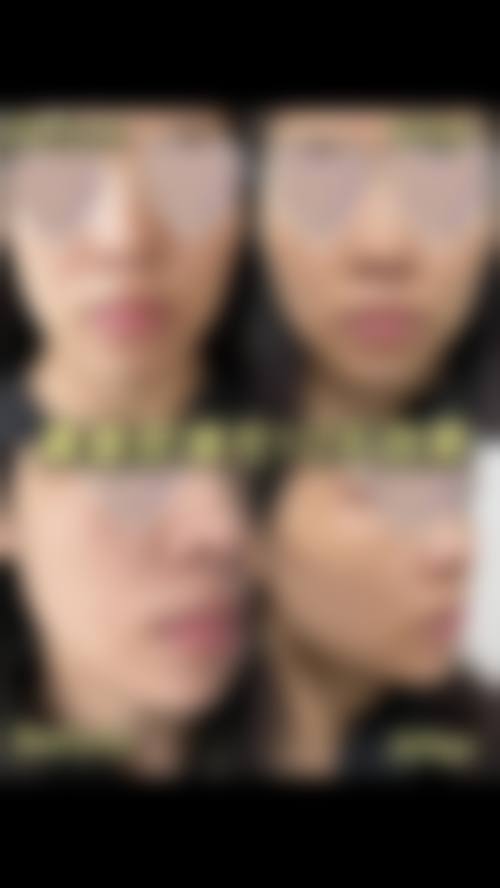 景洪德美医疗美容门诊部怎么样求美者反馈