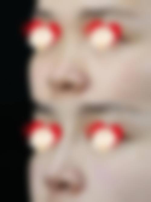 西安博仕相伴整形医院怎么样价格收费