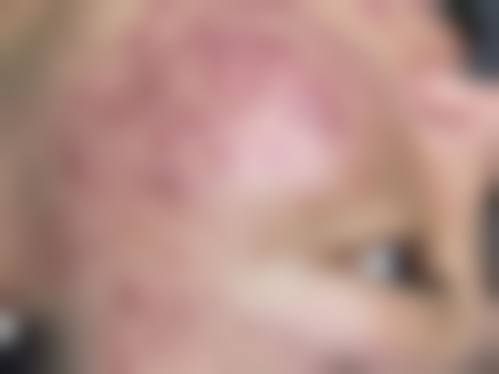 博多Luminous Skin诊所怎么样价格收费