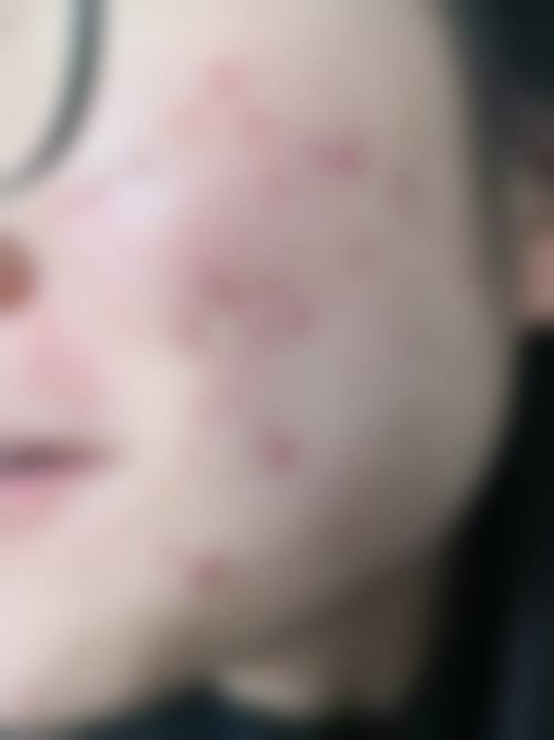 博多Luminous Skin诊所怎么样求美者反馈