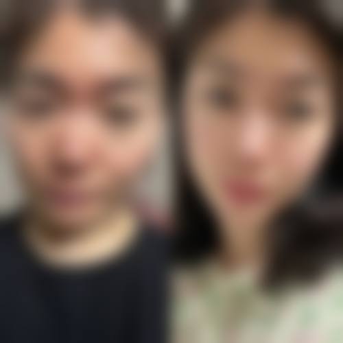 北京伊美尔新伊美医疗美容门诊部怎么样价格收费