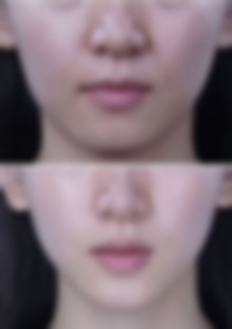 北京伊美尔新伊美医疗美容门诊部怎么样医生团队实力