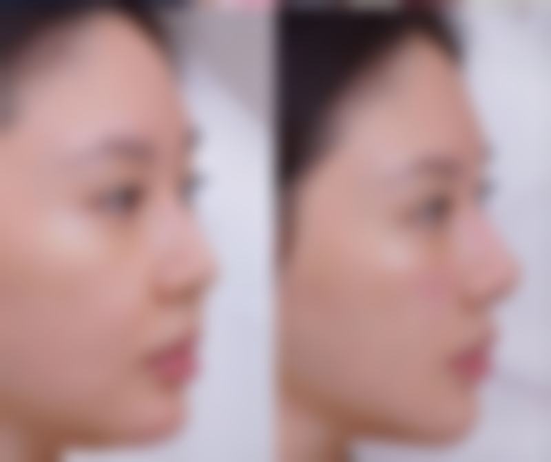 周口市妇幼保健院皮肤美容科怎么样医生团队实力