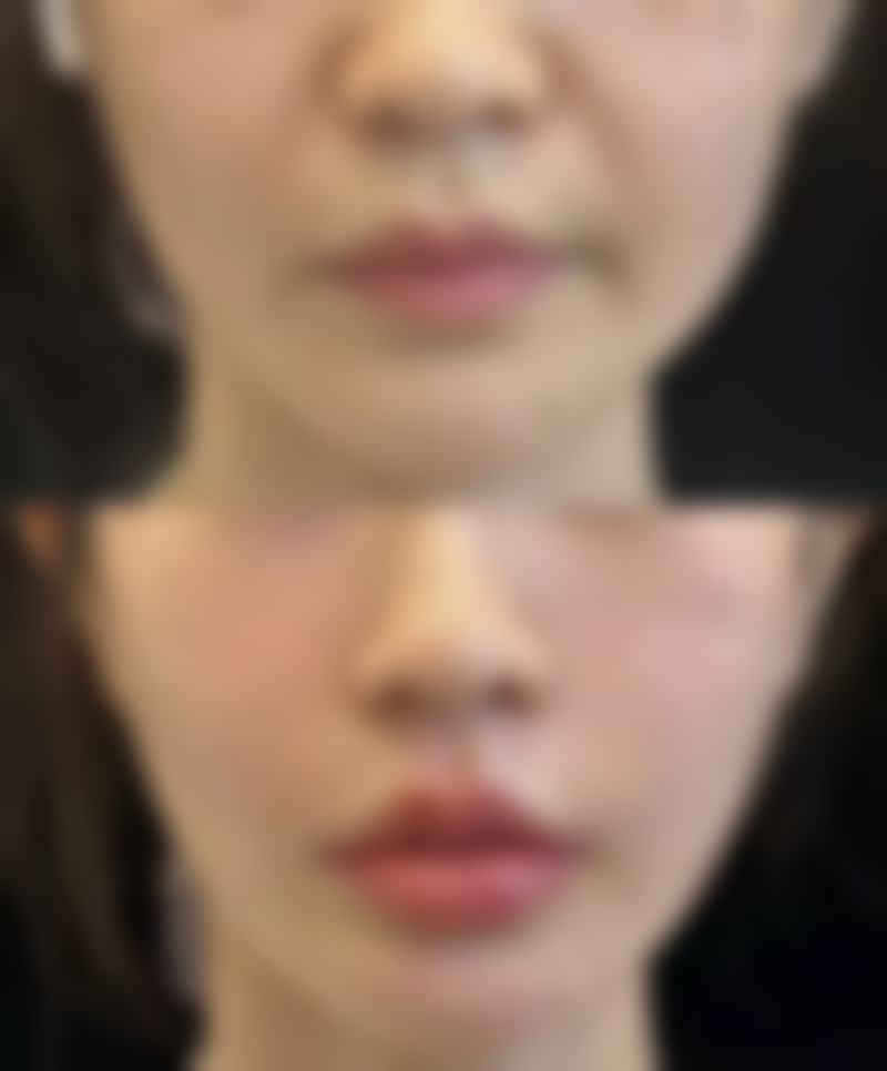 周口市妇幼保健院皮肤美容科怎么样求美者反馈