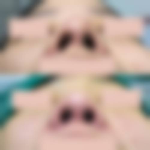 韩国可安美整形外科医院怎么样求美者反馈