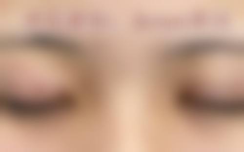 杭州水臻柏妍整形医院怎么样求美者反馈