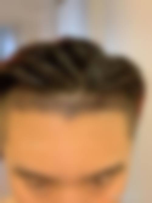 绵阳臻媛奥美恩整形医院怎么样求美者反馈